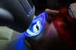 Female receiving teeth whitening procedure. Portrait of a female patient at dentist in the clinic. Teeth whitening procedure with ultraviolet light UV lamp. LED lamp for Teeth whitening procedure