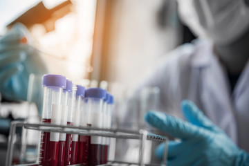 lab technician assistant analyzing a blood sample in test tube at laboratory. Medical, pharmaceutical and scientific research and development concept