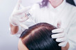 Young woman with hair loss problem receiving injection, close up