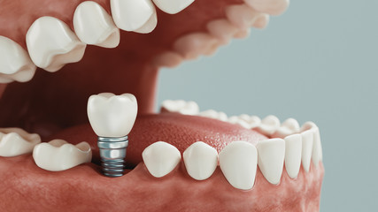 Dental care, 3d rendering