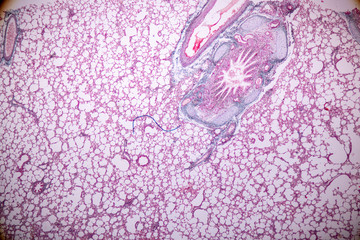 Wall Mural - Concept of Education anatomy and Human lung tissue under microscope, The lungs is organs of the respiratory system in humans.