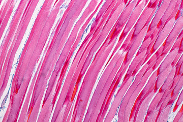 Poster - Education anatomy and Histological sample Striated (Skeletal) muscle of mammal Tissue under the microscope.