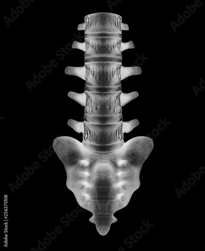 Lumbar Spine X Ray Anatomy - Anatomy Diagram Book