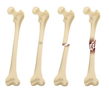 Femur Bone Element Vector Illustration