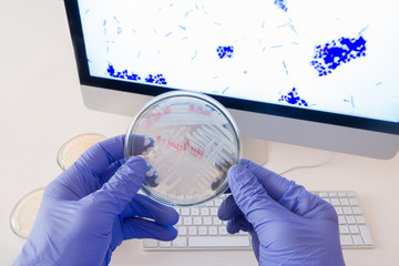 Poster - Analysis of bacteria on a Petri dish in front of a monitor with a photo of bacteria.