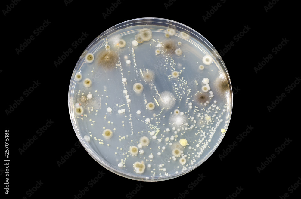 Colonies of different bacteria and mold fungi grown on Petri dish with ...