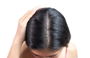 Wall Mural - women head with dandruff Caused by the problem of dirty. Or caused by skin disease or Seborrheic Dermatitis. It has white scaly and it will cause itch.