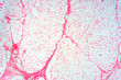 Human fat body tissue under microscope view.