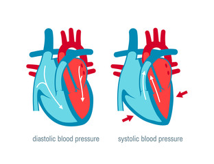 Wall Mural - Blood pressure concept in flat style, vector