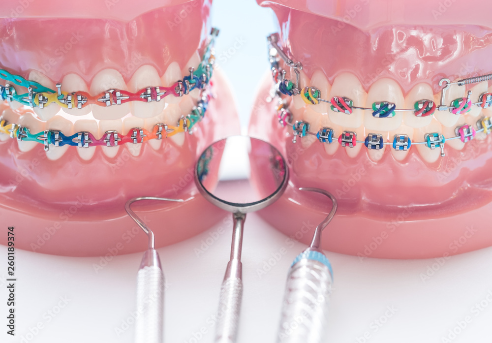 orthodontic model and dentist tool - demonstration teeth model of ...