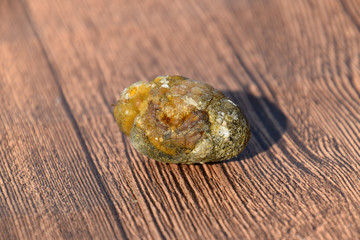 Stone of gallbladder. The result of gallstones. A calculus of dissimilar composition on a wooden background.