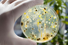Researcher Hand In Glove Holding Petri Dish With Colonies Of Different Bacteria And Molds On Natural Background. Biotechnology Concept