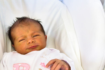 detail of newborn baby face having jaundice