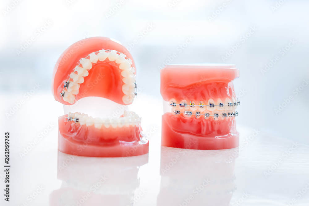 Orthodontic model and dentist tool - demonstration teeth model of ...