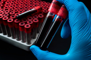 Poster - Blood analysis, clinical or medical testing and phlebotomy concept theme with close up on doctor hand wearing blue latex gloves and holding a test tubes isolated on black background