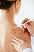 Cropped View Of Dermatologist Applying Marks On Skin Of Naked Woman With Pencil Isolated On White