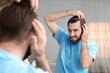 © New Africa - Young man with hair loss problem in front of mirror indoors