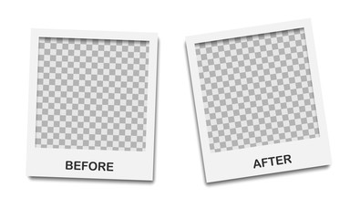 Poster - template background before and after. before and after photo frame. comparison banner with empty spa