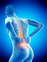 3d rendered medically accurate illustration of a man having acute back pain