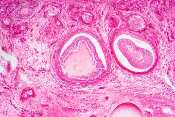 Light microscopic of human ovary showing primary and secondary follicles.