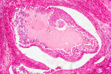 Wall Mural - Light microscopic of human ovary showing primary and secondary follicles.