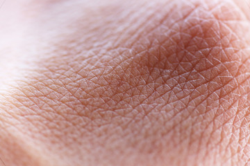 skin macro