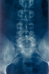 Naklejka na meble Spine RTG