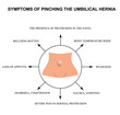 Symptoms of pinching the umbilical hernia. Infographics. Vector illustration on isolated background.