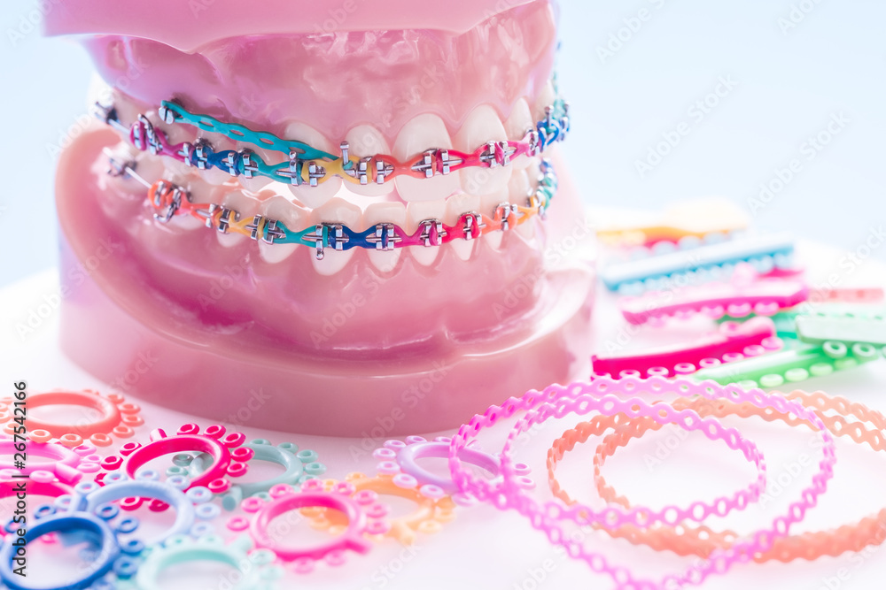 orthodontic model and dentist tool - demonstration teeth model of ...