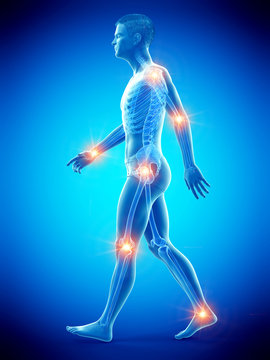 3d rendered medically accurate illustration of painful joints