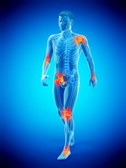 3d rendered medically accurate illustration of a walkers painful joints