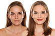 Comparison portrait of young beautiful woman before and after skin treatment and makeup on white backgeound