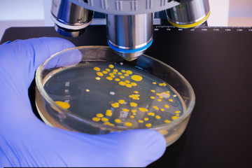 Poster - Close-up scientist puts a petri dish under the microscope for analysis. Analysis of bacterial culture under a microscope. Study of bacteria under a microscope.