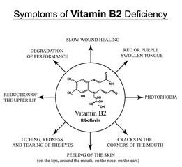 Symptoms of vitamin B2 deficiency. Infographics. Vector illustration on an isolated background.