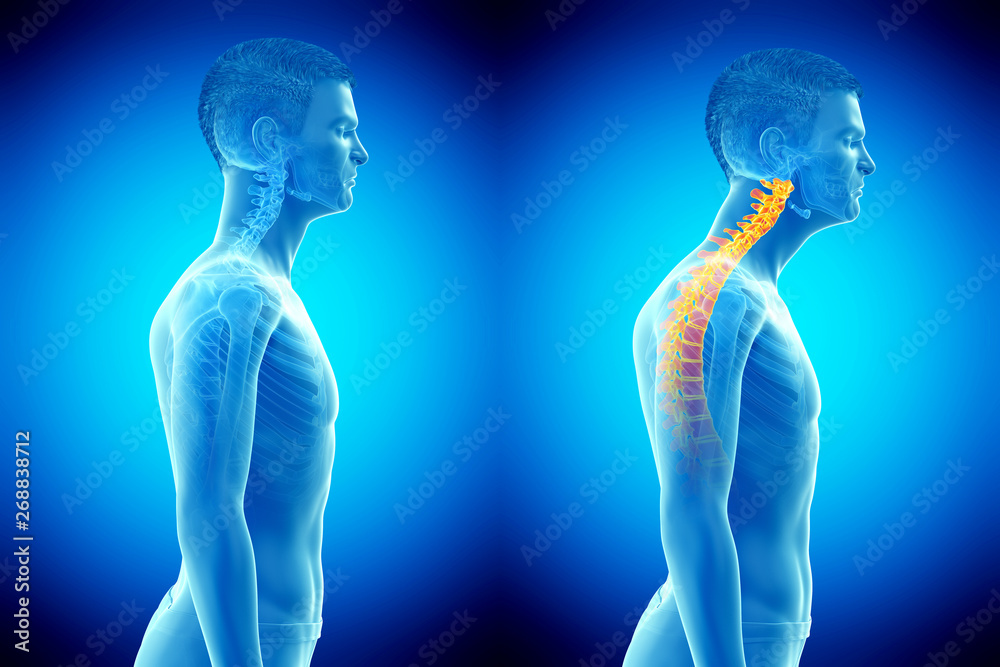 3d rendered medically accurate illustration of a man with a forward head posture - obrazy, fototapety, plakaty 