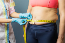 Doctor Taking Obese Patient's Body Fat Measurements