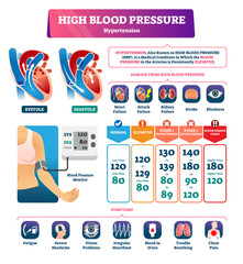 Poster - High blood pressure vector illustration. Labeled systole explanation scheme