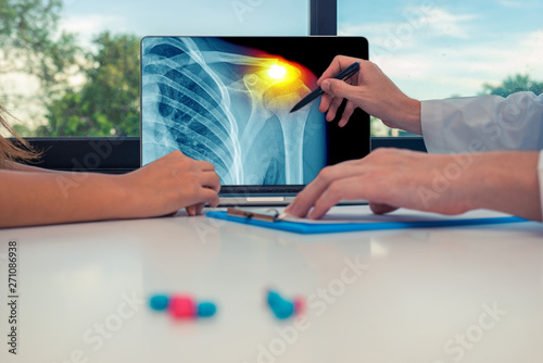 Doctor showing a x-ray of chest with pain on the shoulder on a laptop to a woman patient. Pills on the desk