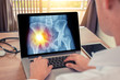 © steph photographies - Doctor watching a x-ray of hips with pain on the left. Radiology concept