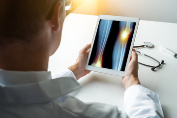 Wall Mural - Doctor holding a digital tablet with x-ray of legs with pain in the ankle and knee