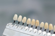 Close up of shade guide to check veneer of teeth for bleaching