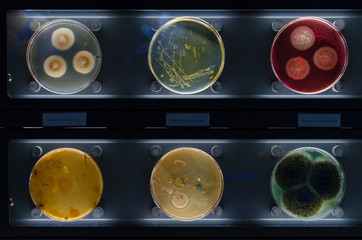 different samples with kinds of bacterias living at common household items. penicillium citrinum, staphylococcus aureus, aspergillus arachidicola.  background