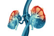 Kidney disease. Kidney cross section