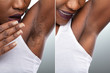 © Andrey Popov - Before And After Concept Of Underarm Hair Removal