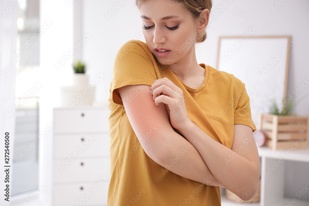 Woman scratching arm indoors, space for text. Allergy symptoms - obrazy, fototapety, plakaty 