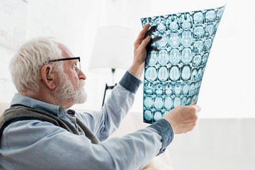 Canvas Print - Calm senior man in glasses looking at x-ray picture