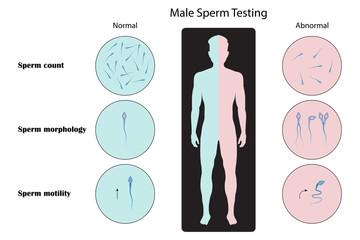 Wall Mural - Male sperm testing analysis and structure , vector ESP10