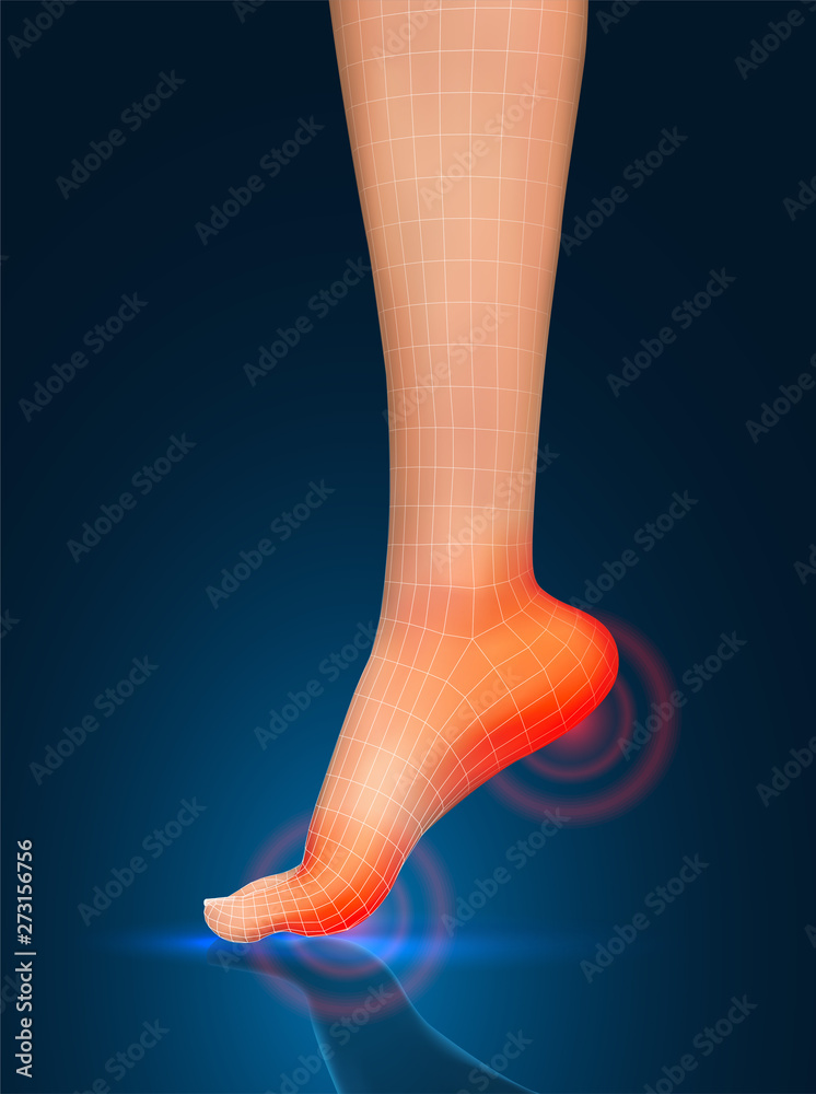 vector human foot.red spots of pain. ready element for medicine and orthopedics