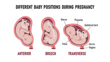 Different Baby Positions During Pregnancy