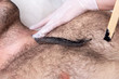Closeup of male chest with hair and wax. Professional shugaring master in gloves makes depilation to a young man in the salon